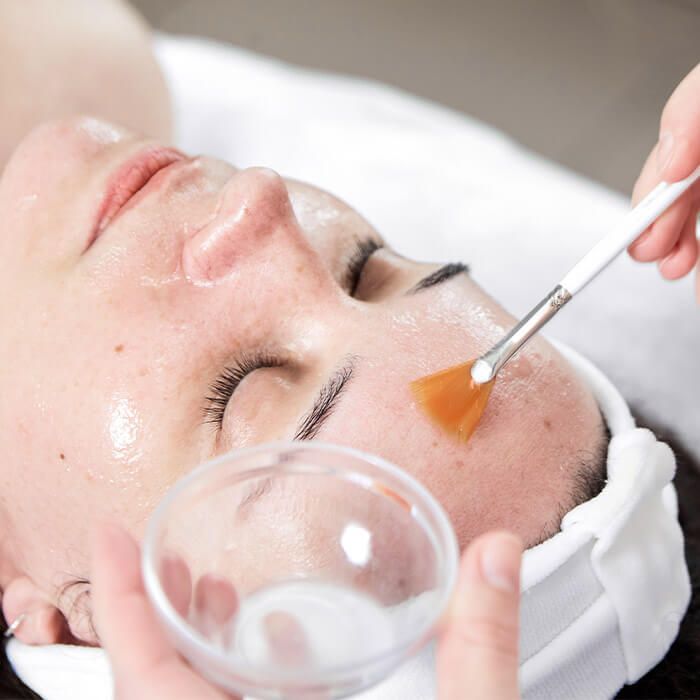 Peel Da Trị Mụn Bao Lâu Thì Hết Mụn?